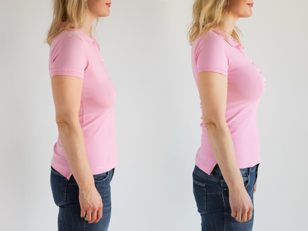 Best Cosmetic Surgeon in Mumbai for Breast lift surgery